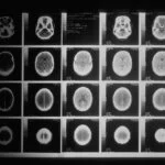 "Black and white brain CT scan images arranged in a grid."